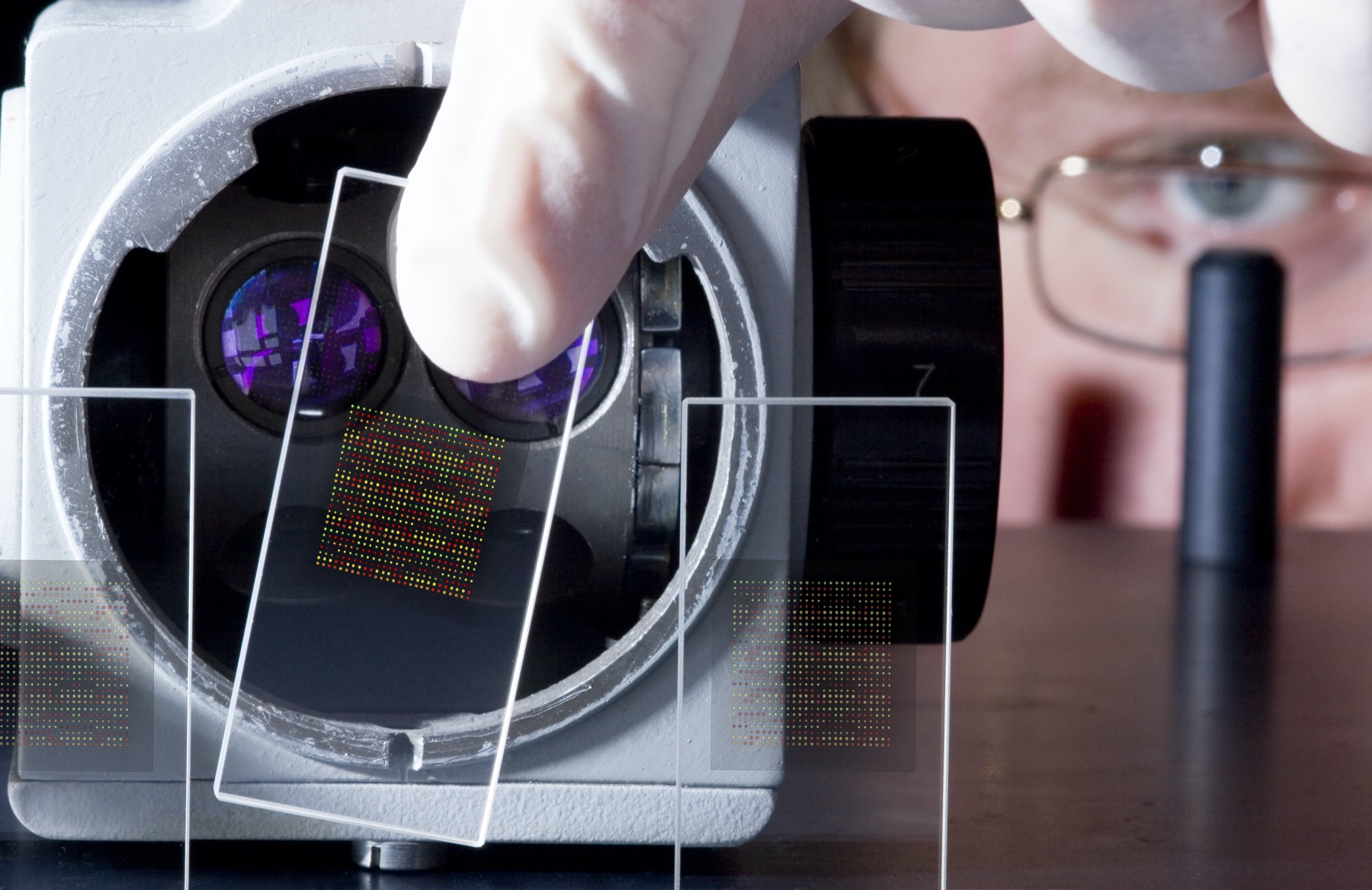 DNA Chips