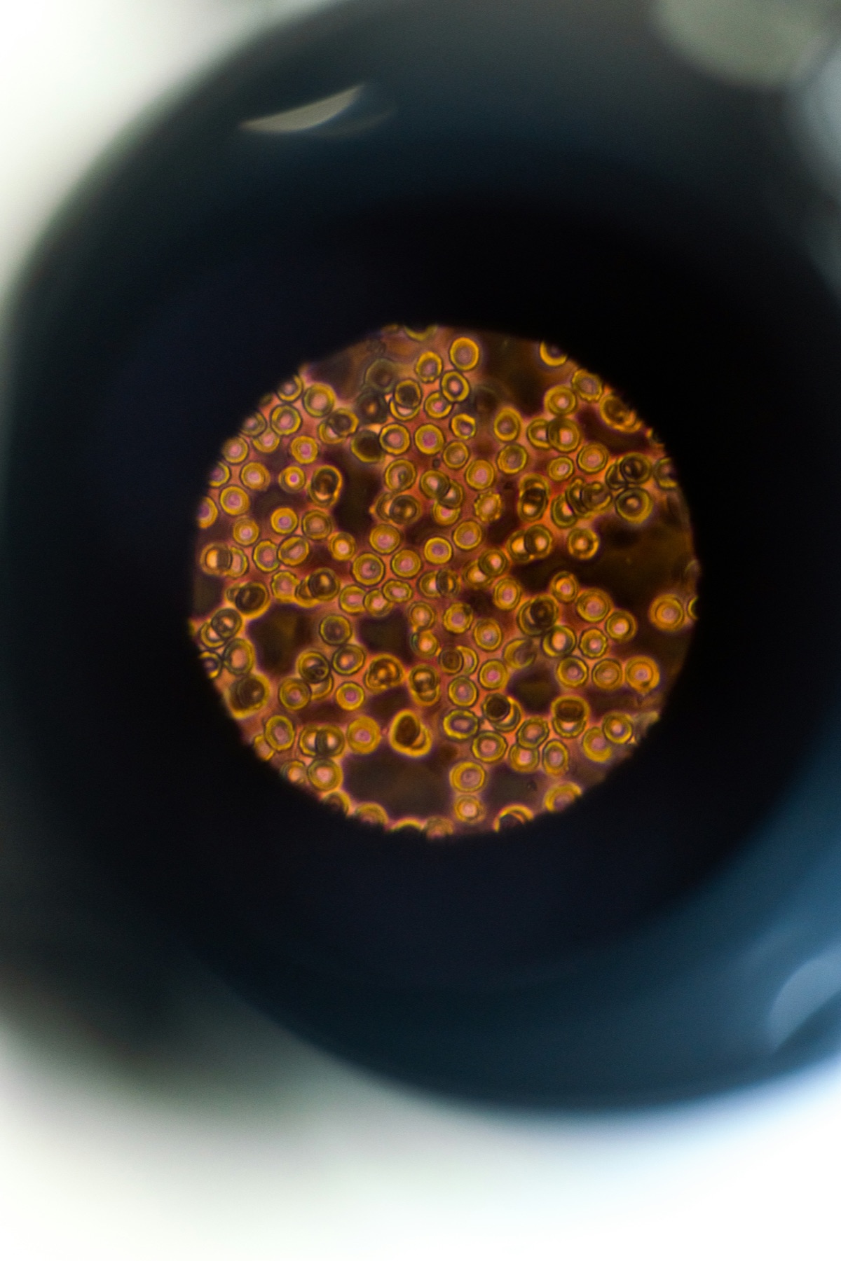 Microscopic View of blood sample